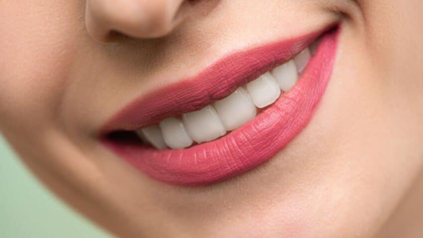 Fogászati fogfehérítés a MyDent fogorvos kínálatában